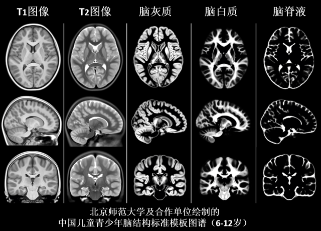 6北師大及合作單位繪制的中國兒童青少年腦結構標準模板圖譜.png